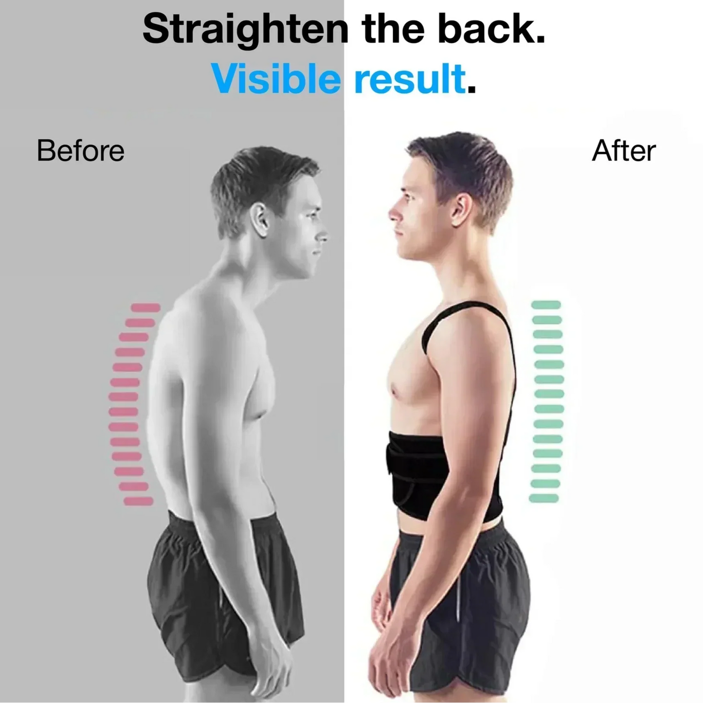HZA™ Posture Corrector – Pain Relief & Confidence Boost