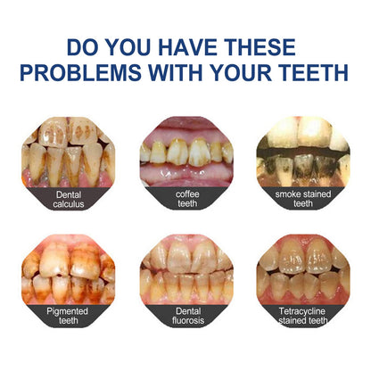 Final Day 60% OFF-BBOJI™- Fluoride-Free Hydroxyapatite Toothpaste-